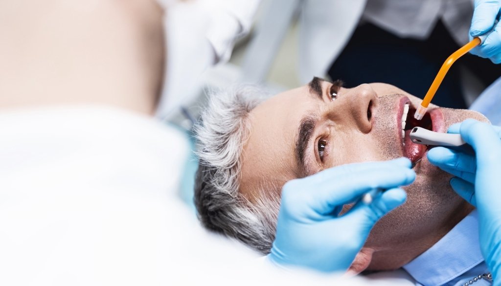root canal