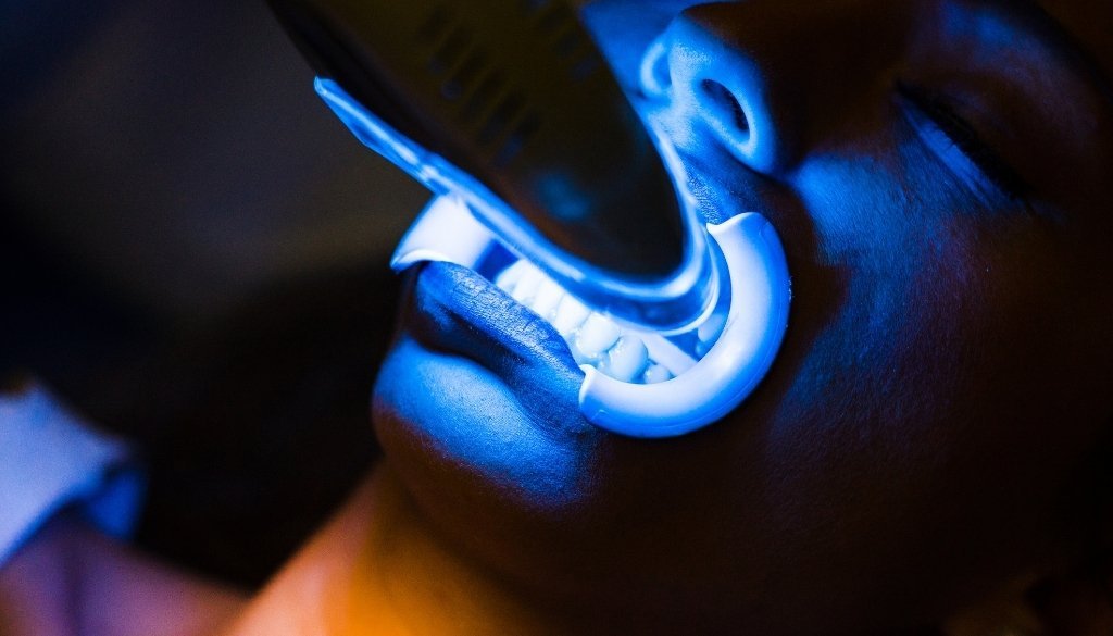 laser tooth extraction