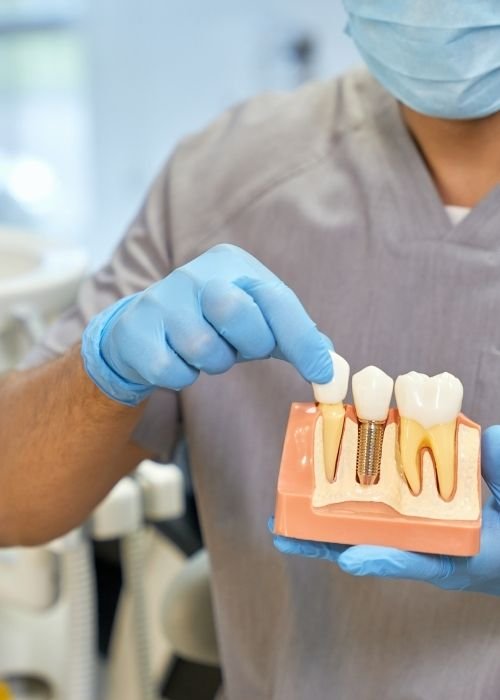 best dental implants treatment