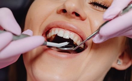 We provide advanced solutions for gummy smile correction, including precise gum contouring, to help you achieve a more balanced and radiant smile.