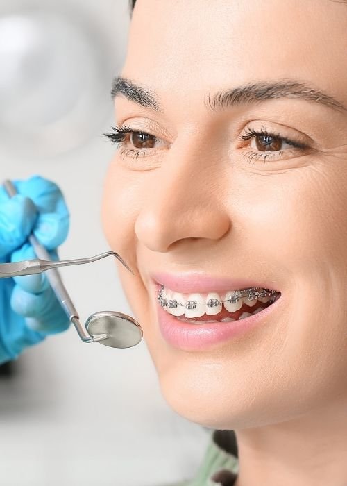 orthodontic braces in dubai