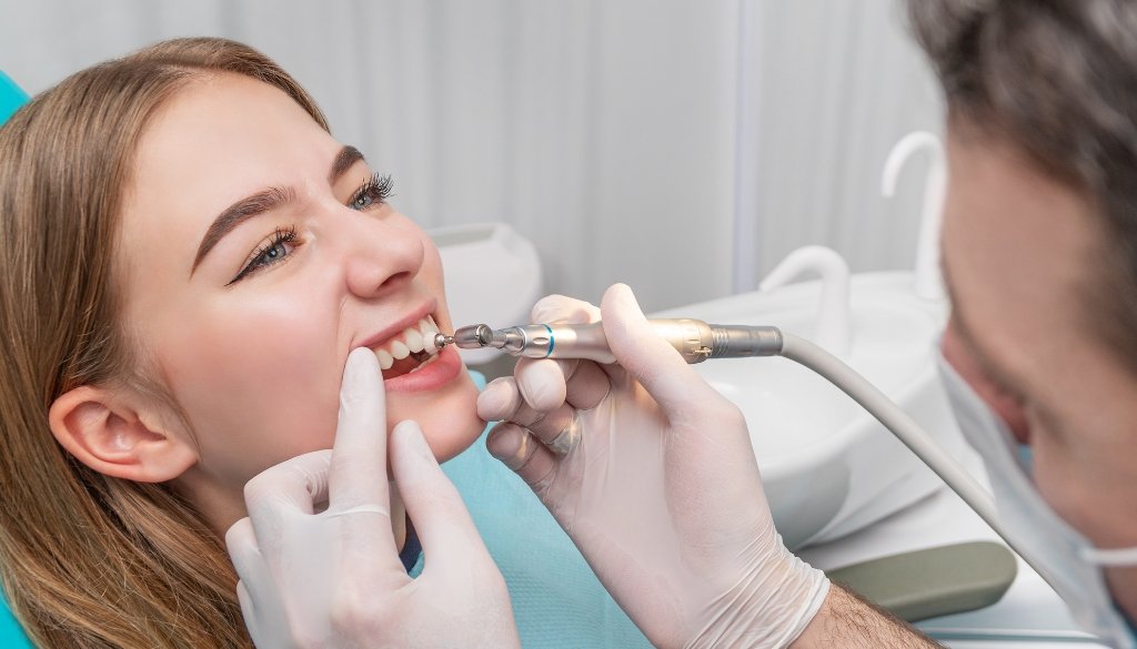 tartar removal