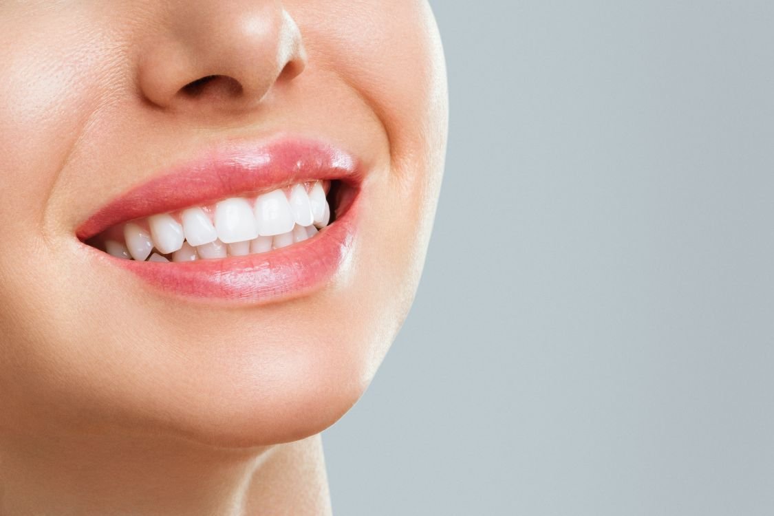 teeth whitening in dubai