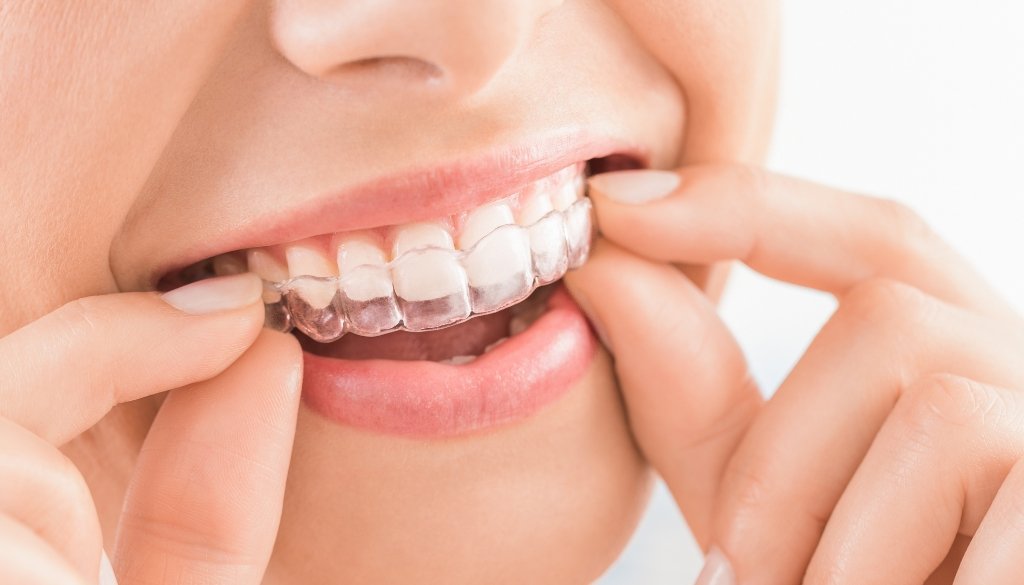 orthodontist dubai
