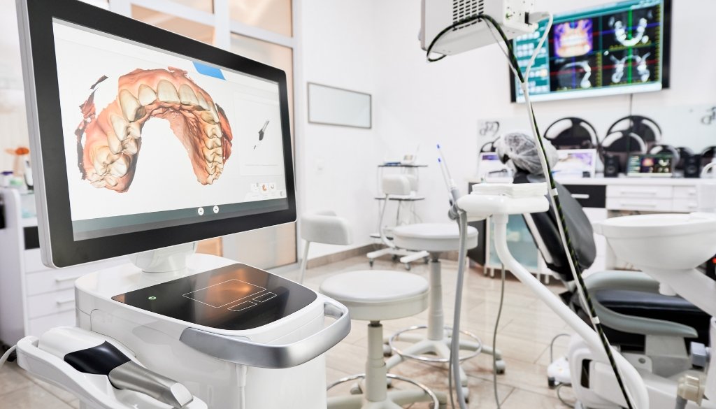 dental impressions